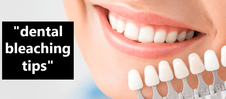 Dental Bleaching Tips